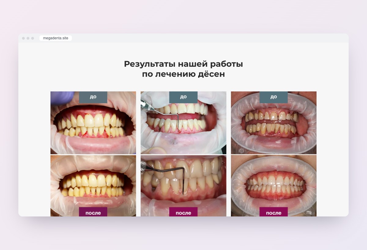 фото кейса