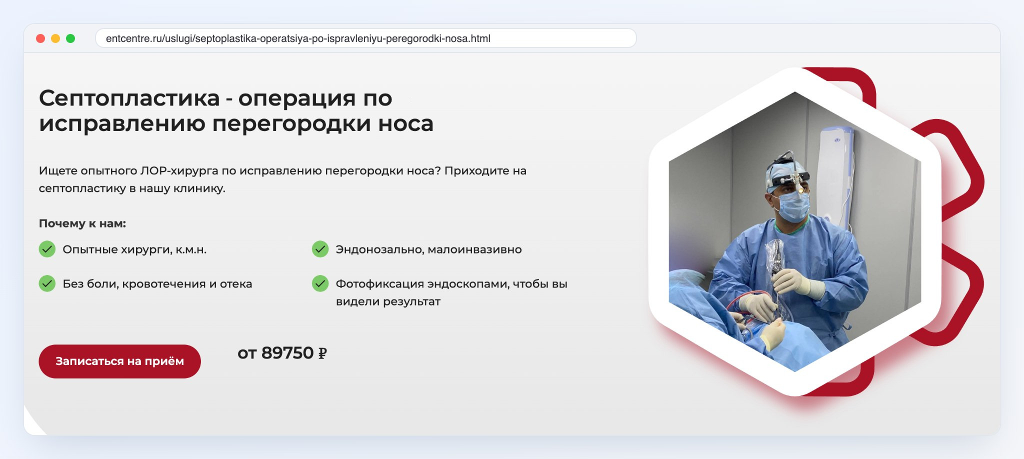 Первый экран страницы услуги «Септопластика» на сайте клиники «ЛОР Центр»: заголовок-запрос, 4 преимущества, цена и кнопка записи